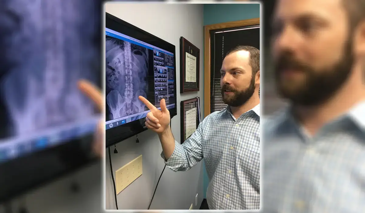lower back x-ray for treating disc bulges