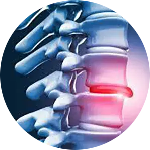 Disc Injury Conditions Treatment Chiropractor Arlington Heights, IL